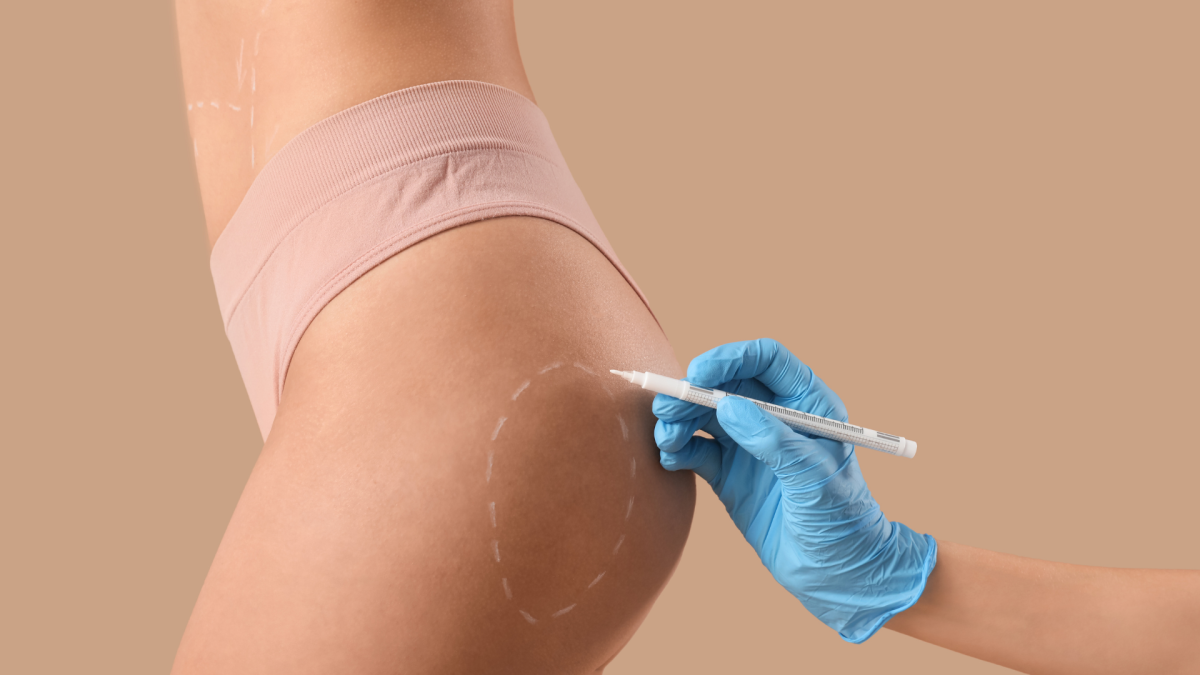 DRV Clinic offers brazilian bum lift treatment in london, uk